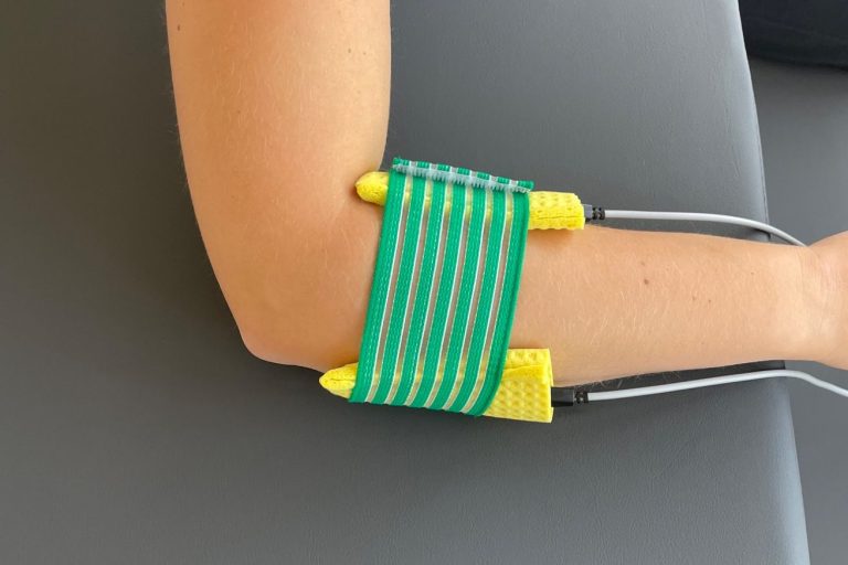 Physiologisch Unterarm mit Elektroden